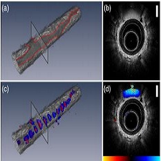 In vivo lung microvasculature visualized in three dimensions using fiber-optic color Doppler optical coherence tomography