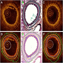 Validation of airway wall measurements by optical coherence tomography in porcine airways