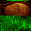 A high-efficiency fiber-based imaging system for co-registered autofluorescence and optical coherence tomography