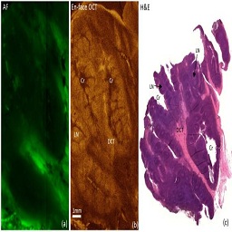 Optical Coherence Tomography and Autofluorescence Imaging of Human Tonsil