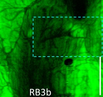 Endoscopic high-resolution autofluorescence imaging and OCT of pulmonary vascular networks