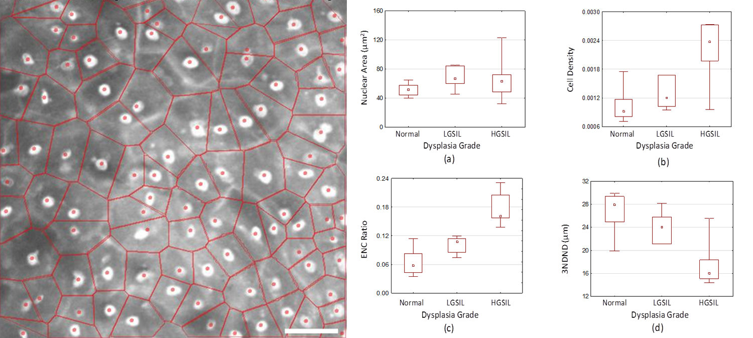 Confocal-Discrimination