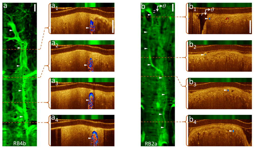 oct-afi-vasculature