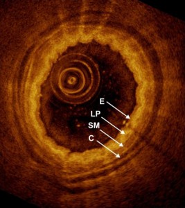 pig-airway-oct