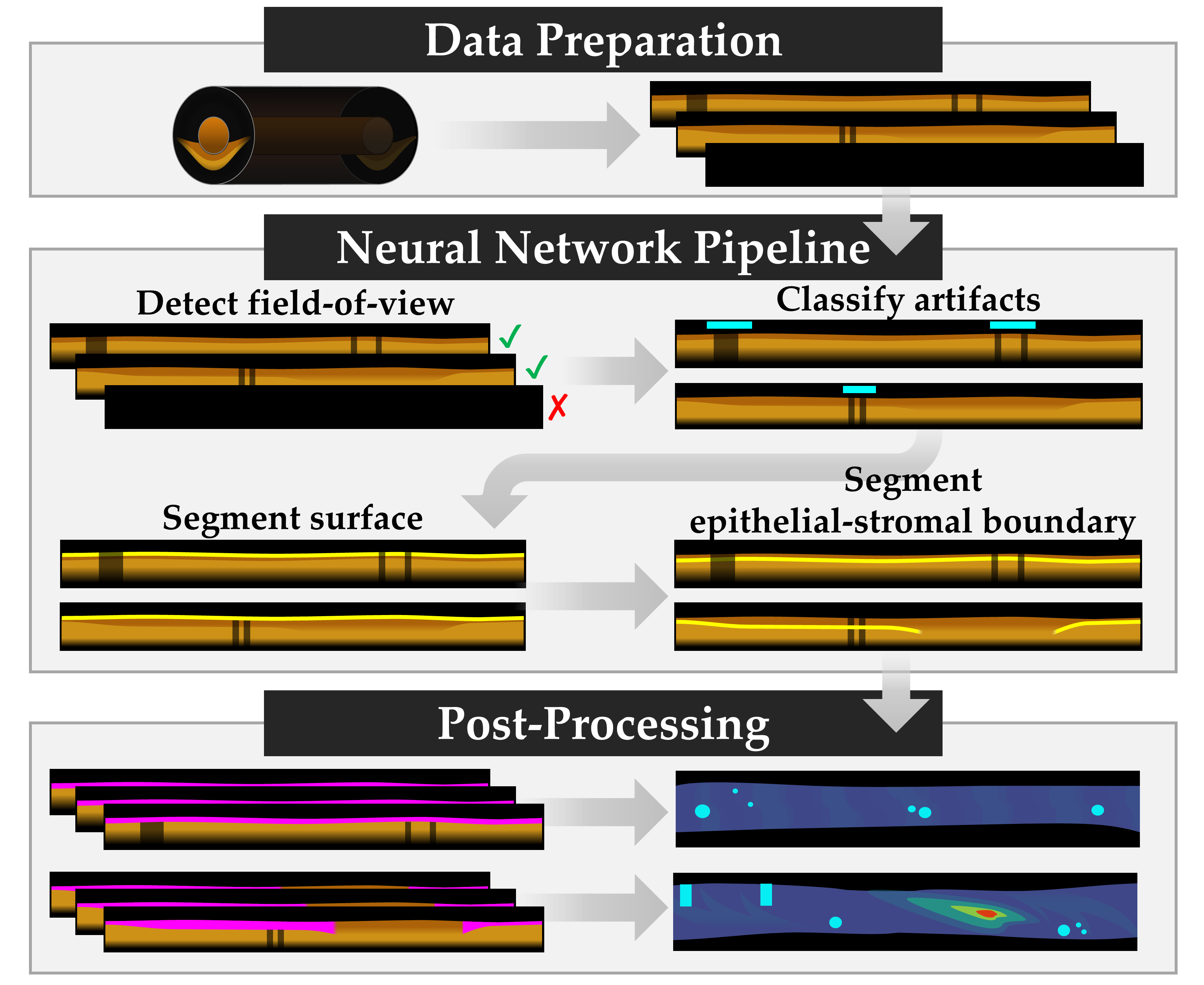 Three-Dimension Epithelial Segmentation in Optical Coherence Tomography of the Oral Cavity Using Deep Learning