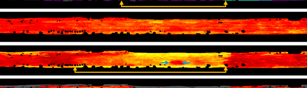 New publication on OCT biomarkers of oral dysplasia and carcinoma