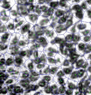 In vivo pathology: microendoscopy as a new endoscopic imaging modality