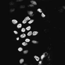 Optical computed-tomographic microscope for three-dimensional quantitative histology